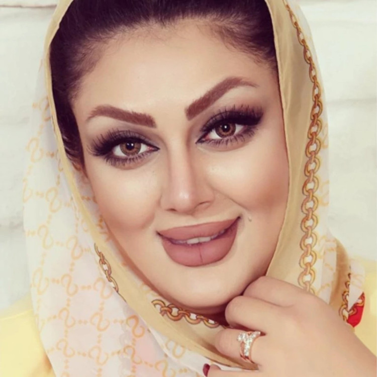 لنز فصلی دهب سان کیس SUN KISS رنگ قهوهای عسلی دوردار