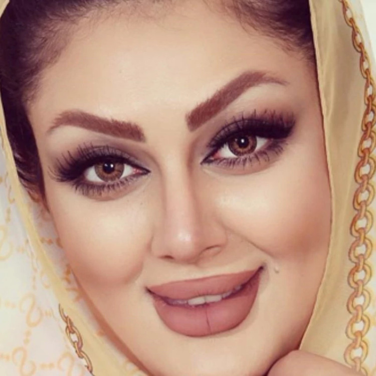 لنز فصلی دهب سان کیس SUN KISS رنگ قهوهای عسلی دوردار